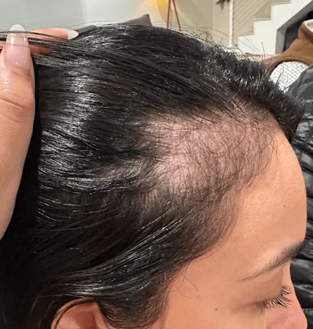 Ignite Your Hair's Natural Growth